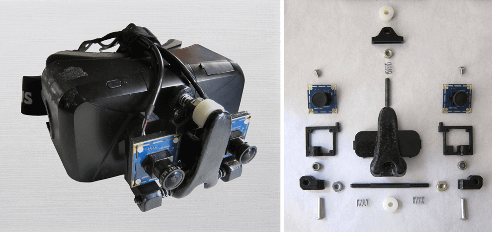 novel-mixed-reality-navigation-laparoscopic-surgery-2